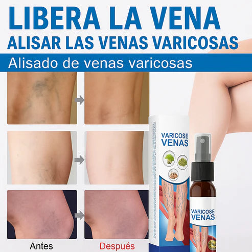 SPRAY VARISTOP™ - Elimina la sensación de "piernas pesadas"